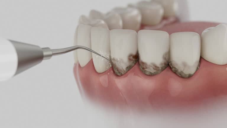 Trusted Root Canal Treatment service in Athens, MI - Dentist Open Now